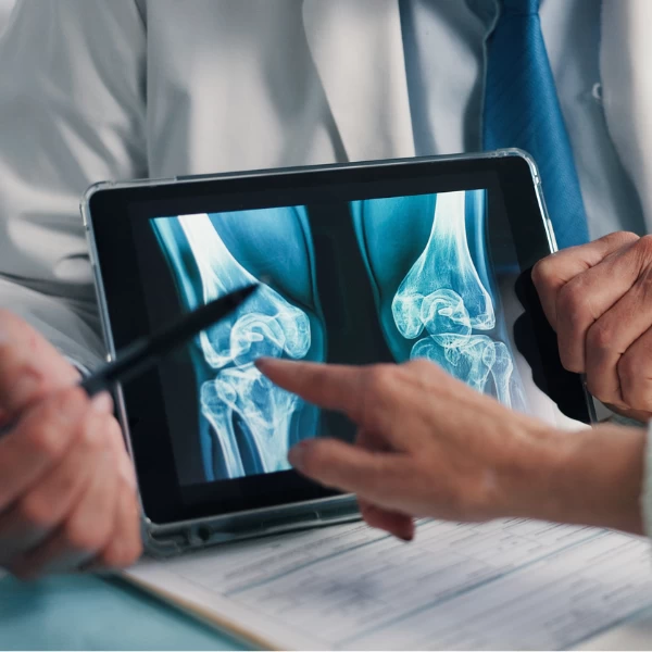 5 Sinais de que você pode estar com falta de cálcio